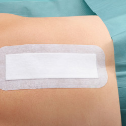 Cosmopor® E αυτοκόλλητο επίθεμα τραύματος