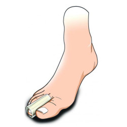 ΔΙΑΧΩΡΙΣΤΙΚΟ GEL ΔΑΚΤΥΛΟΥ "PROTECTOR TUBE"
