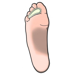 ΠΕΛΜΑΤΑ GEL ΣΦΥΡΟΔΑΚΤΥΛΙΑΣ "TOE CREST"