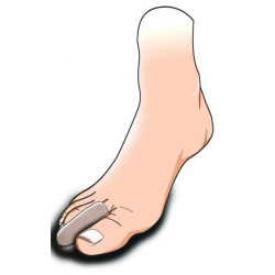 ΠΡΟΣΤΑΤΕΥΤΙΚΟ GEL ΔΑΚΤΥΛΟΥ "TOE CUP"